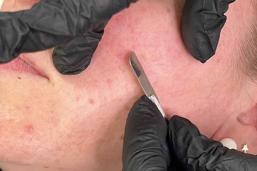 Dermaplaning facial by The Hidden Retreat