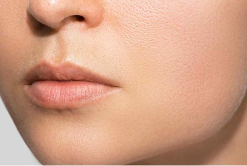 lip filler before photo