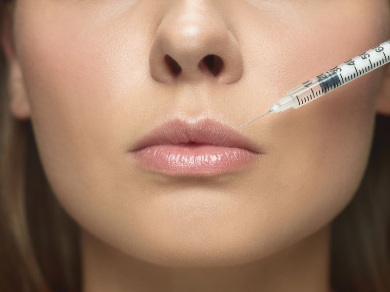 face ofa woman having a lip filler injection
