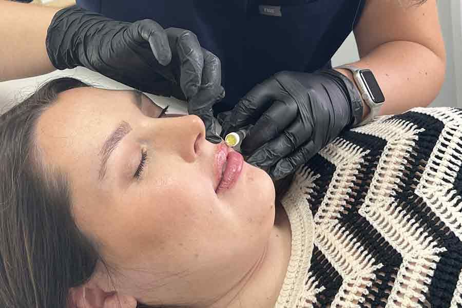 Woman recieving a hydration booster injection in her chin area